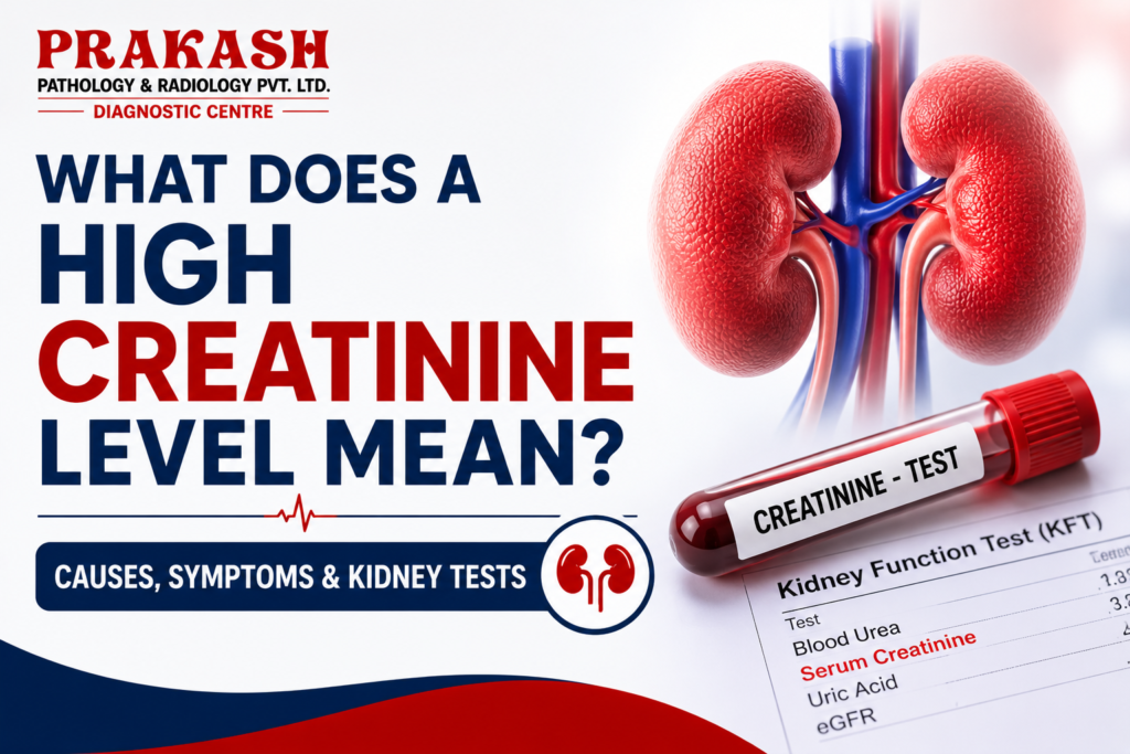 What Does a High Creatinine Level Mean? Causes, Symptoms & Kidney Tests