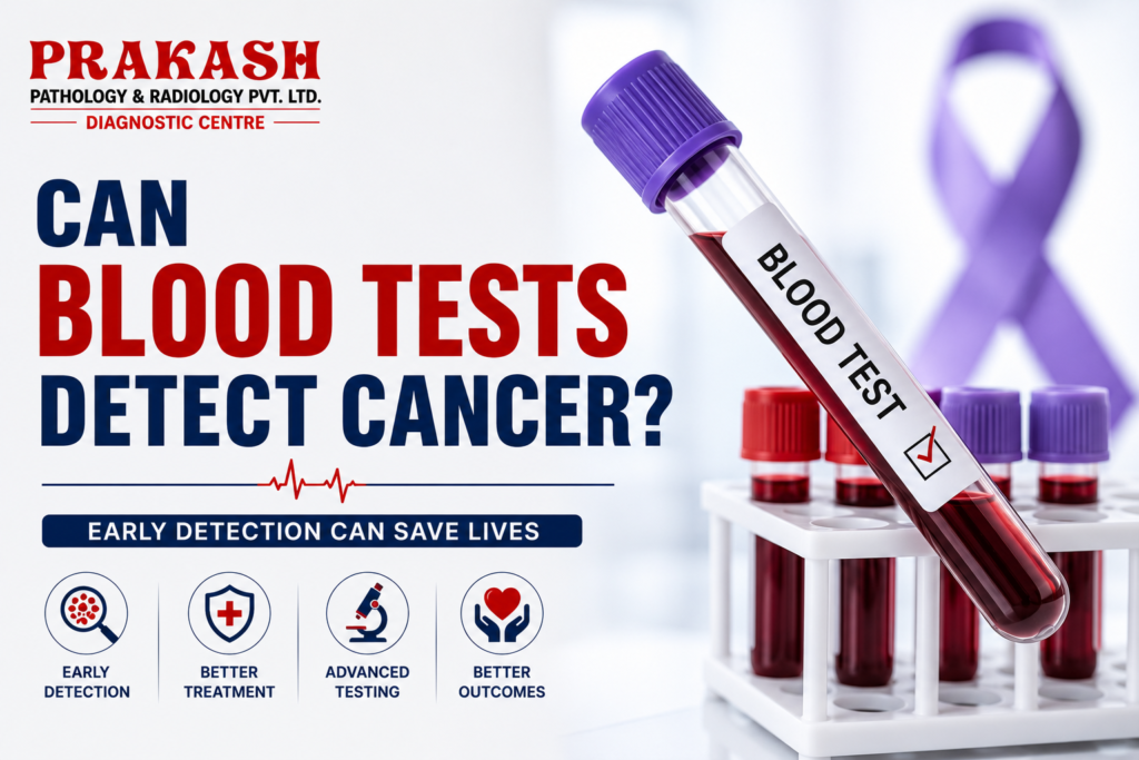 Can Blood Tests Detect Cancer?