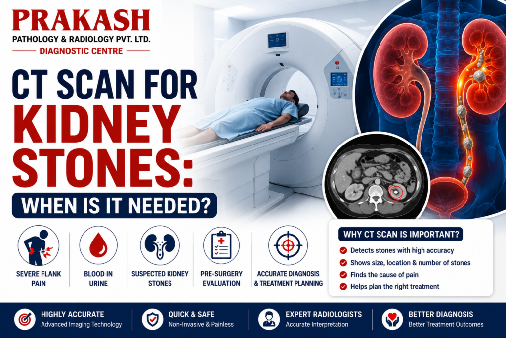 CT Scan for Kidney Stones: When Is It Needed?