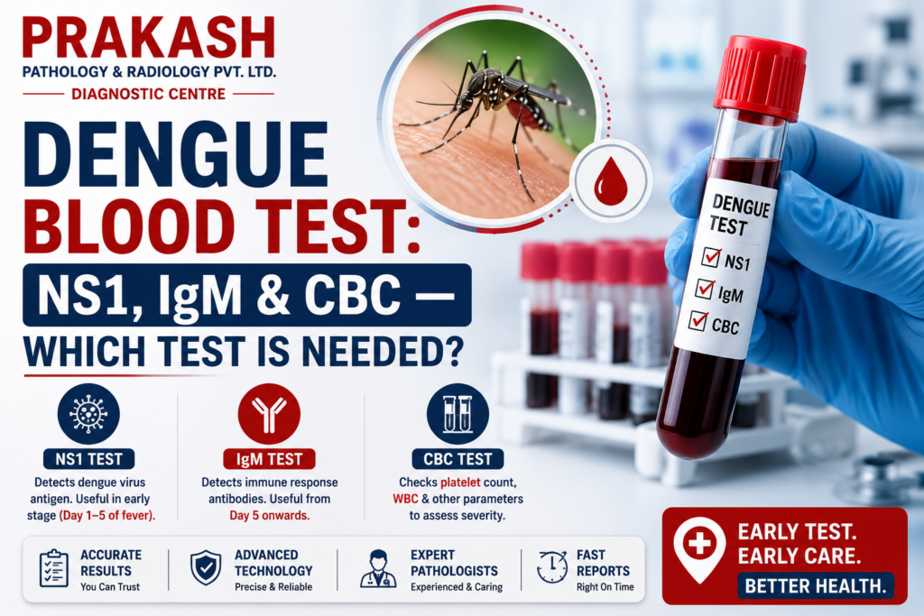 Dengue Blood Test: NS1, IgM & CBC — Which Test Is Needed?