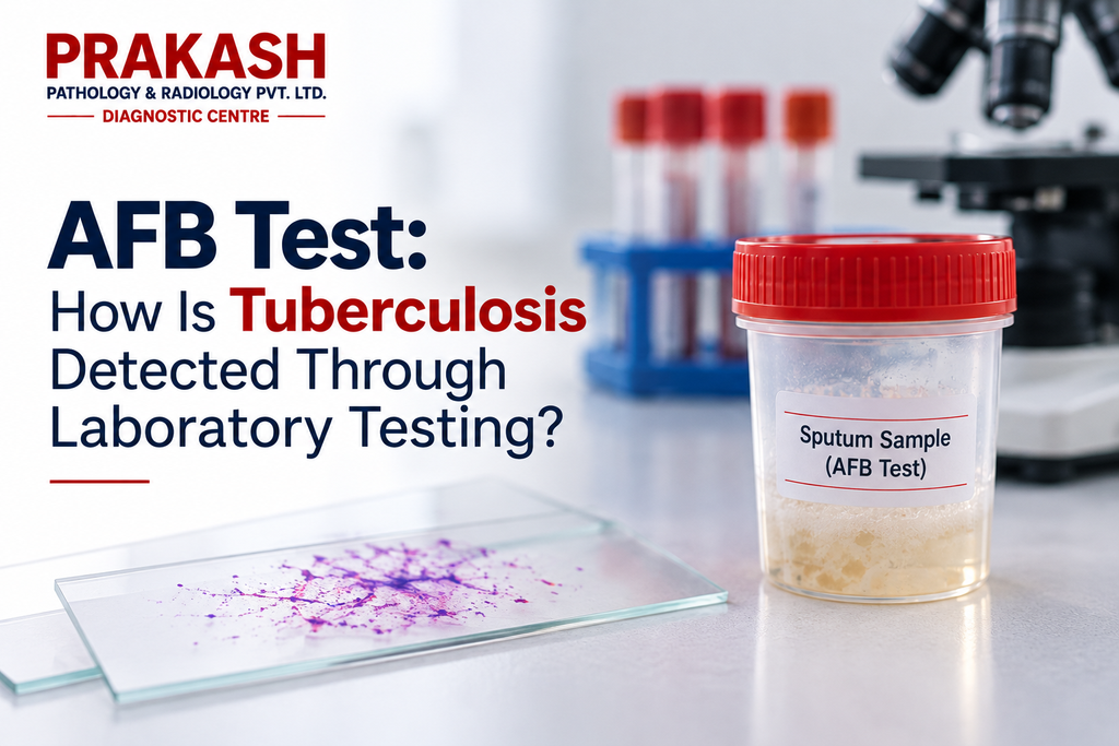 AFB Test: How Is Tuberculosis Detected Through Laboratory Testing?