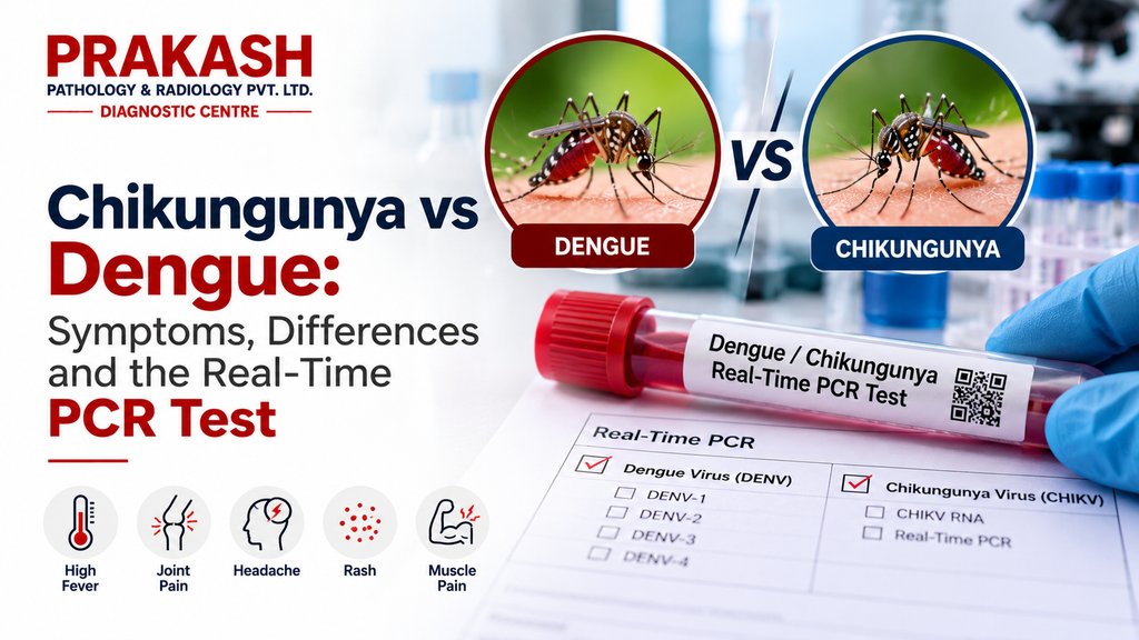 Chikungunya vs Dengue: Symptoms, Differences and the Real-Time PCR Test