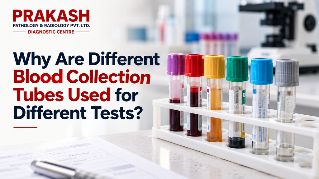 Why Are Different Blood Collection Tubes Used for Different Tests?